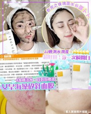 Luxury女皇奇蹟無痛矽針面膜