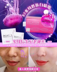 DeliftoxB3奇蹟手母白精靈
